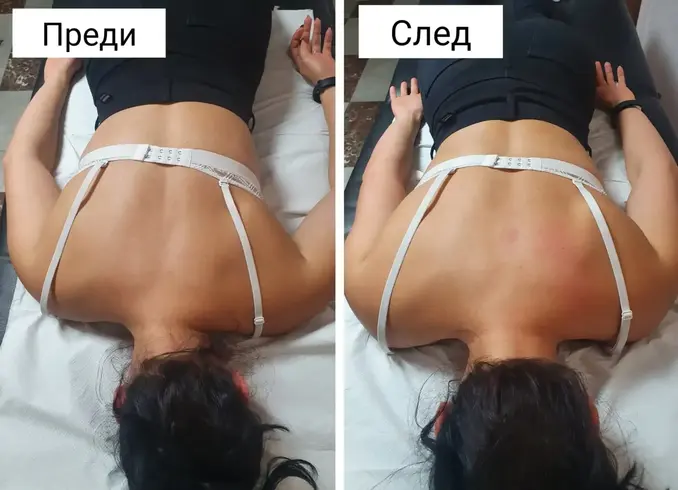 Масаж и лечебни техники в Петрич и Сандански - портфолио снимка 5