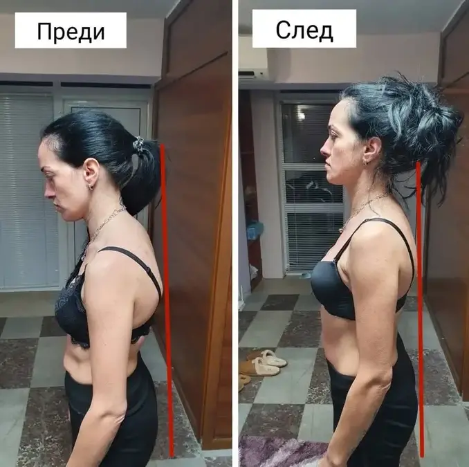 Масаж и лечебни техники в Петрич и Сандански - портфолио снимка 6