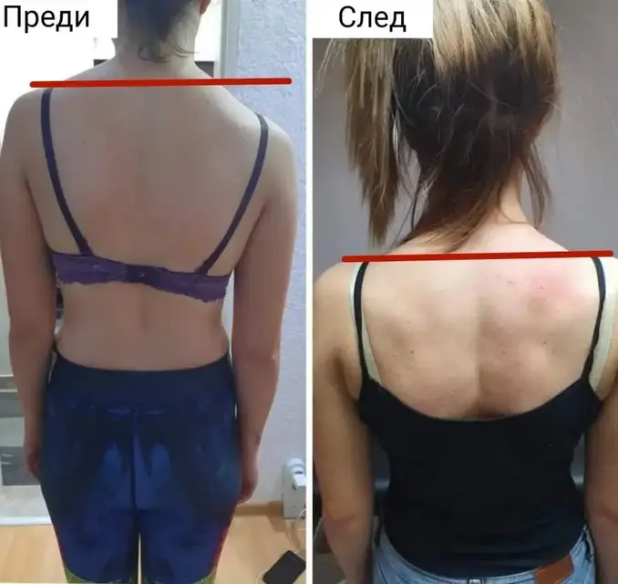 Масаж и лечебни техники в Петрич и Сандански - портфолио снимка 7